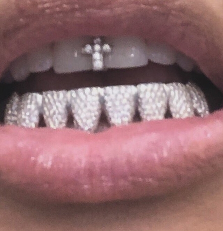 Kim Kardashian Flaunts Her New Diamond Grillz on Instagram ...