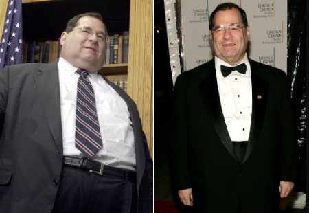 Jerrold Nadler before and after the surgery.