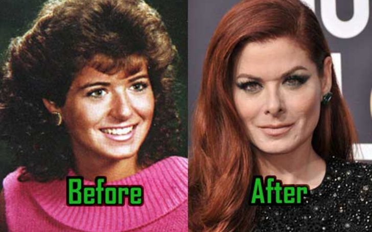 Debra Messing Plastic Surgery The Full Story Glamour Fame