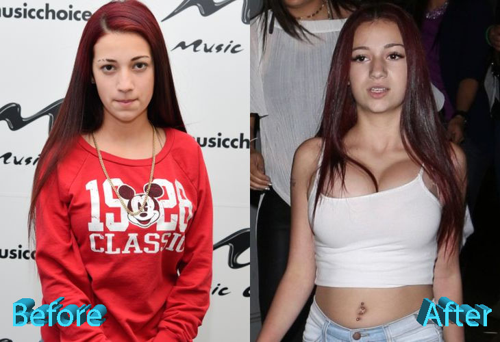 Bhad bhabie breast