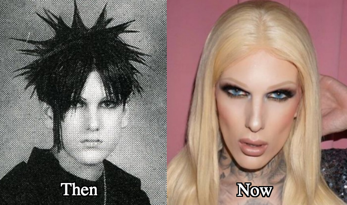 Jeffree Star Before And Now Jeffree Star Jeffree Star Jefree Star Stars Jeffree Star Is