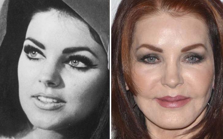 priscilla presley plastic surgery