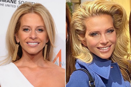 Dina Manzo Before and After Plastic Surgery: She did her nose and used some Botox to look younger.