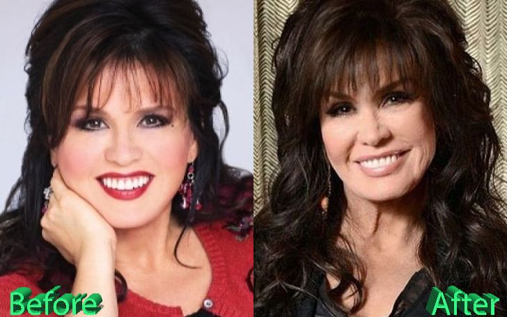 Marie Osmond Recalls Her Weight Struggles