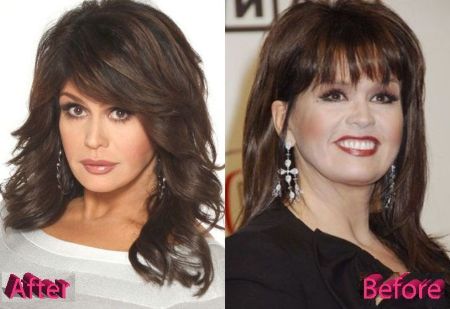 Marie Osmond's After and Before photo of weight loss.