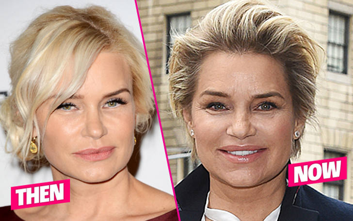 Yolanda Hadid Plastic Surgery - Mother of Hadid Kids got rid of Her ...