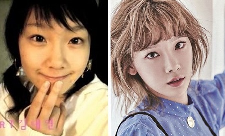 Before and after photos of Taeyeon which shows no significant differences except her chubbiness in the jawline.