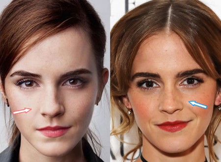 Emma Watson nose job pictures.