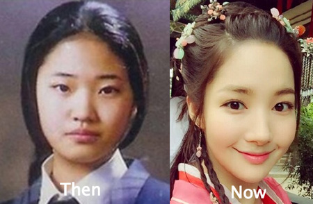 Park Min Young face also seems to have gone through some surgeries.