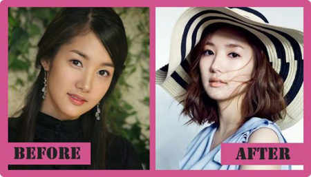 Before and After comparisons of Park Min Young features.