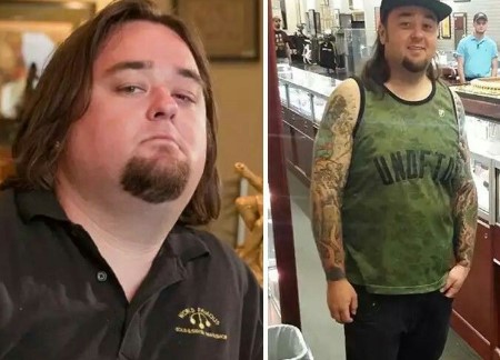 Chumlee's weight loss surgery journey