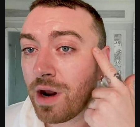 sam smith hair transplant surgery.