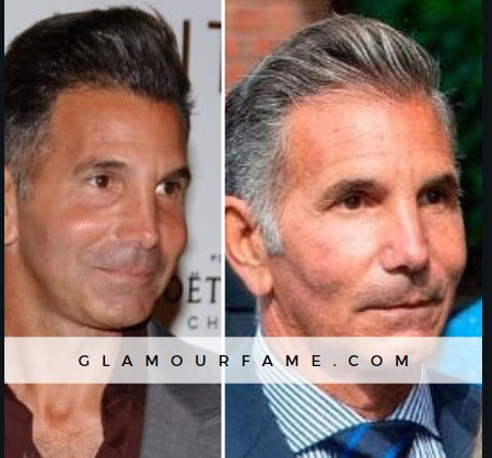 mossimo giannulli plastic surgery before and after.