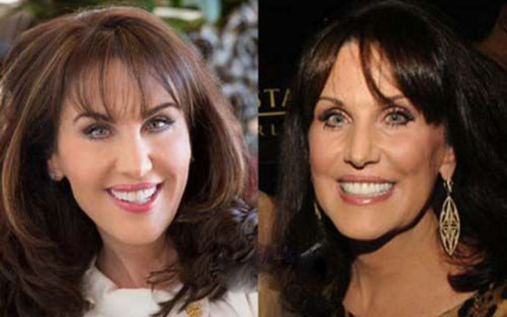 Dr. Phil's Wife Robin McGraw Plastic Surgery - Did She Really Go Under...