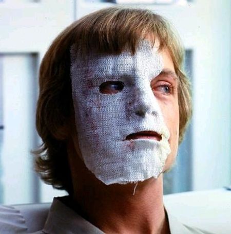 The Star Wars star Mark Hamill plastic surgery is a unslove mystrey.
