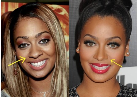 It seems La La Anthony did get a nose job.