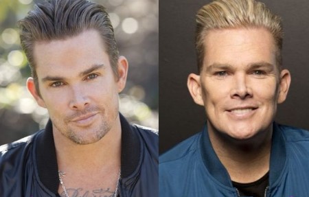 Mark McGrath Plastic Surgery.