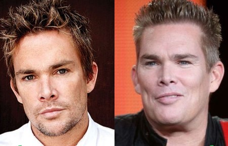 Mark McGrath Plastic Surgery.