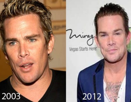 Mark McGrath Plastic Surgery.