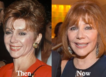 joy philbin plastic surgery.