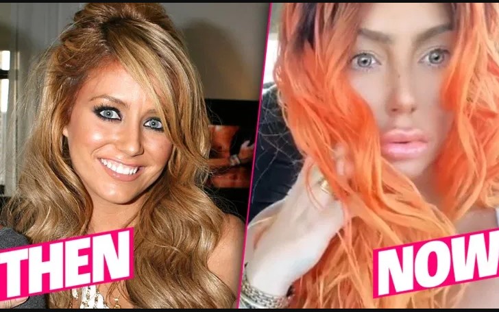 Aubrey O'day Plastic Surgery, Did She Go Under the Knife?