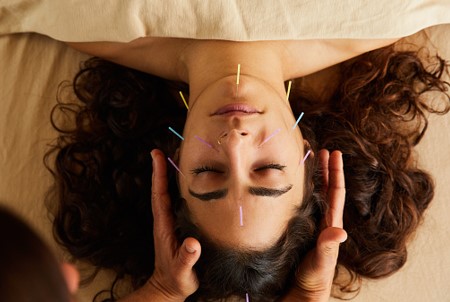 Beauty Benefits of Acupuncture