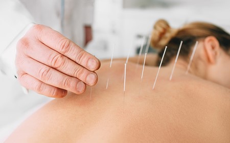 Beauty Benefits of Acupuncture