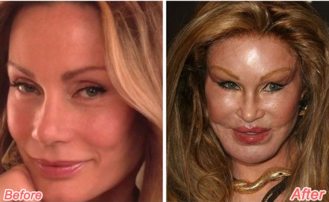 Jocelyn Wildenstein Before Plastic Surgery: All Details