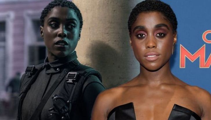 Did Lashana Lynch Undergo Plastic Surgery? Learn all the Details Here