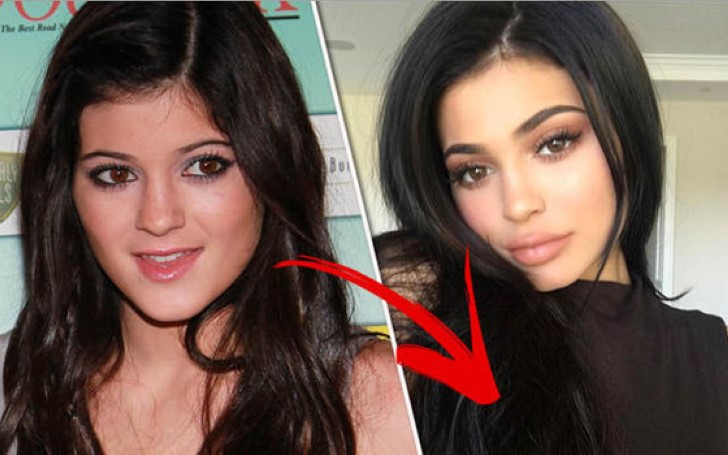 Kylie Jenner Slams Plastic Surgery Rumors and Reveals a Good Reason Her Looks Have Transformed